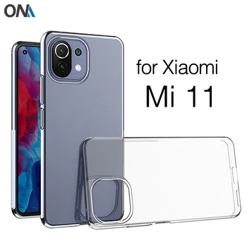 Для Mi11 Чехол Для Xiaomi Mi 11 5G Pro/Ultra/Lite TPU Силиконовый Прозрачный Бампер Мягкий Чехол для Xiaomi Mi 11X Pro Задняя крышка